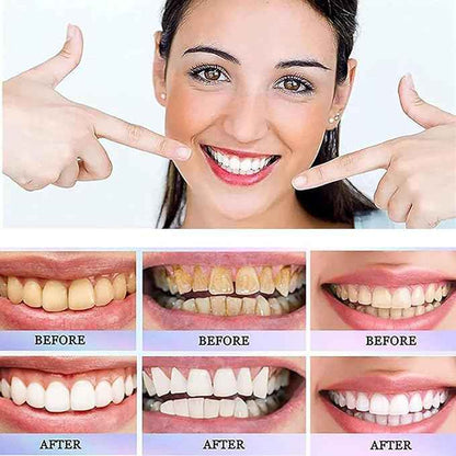 Oralhoe Nicotinamide Whitening Toothpaste – 100 g