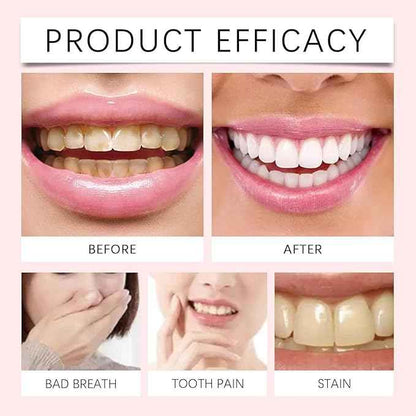 Oralhoe Nicotinamide Whitening Toothpaste – 100 g