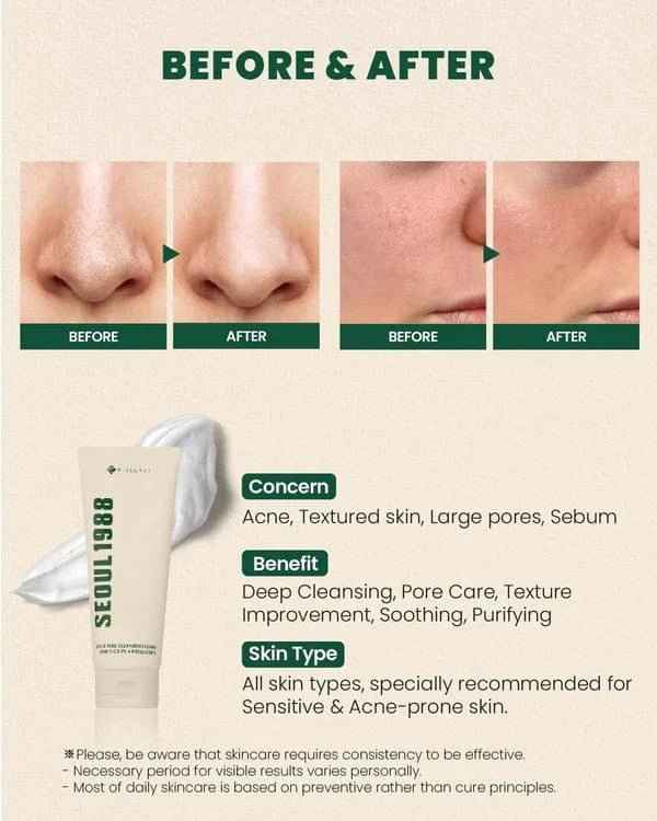 Seoul 1988 Pine Cica Cleansing Foam – 150 ml