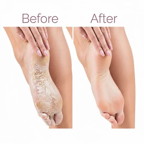 Electric Pedicure Foot File Callus Remover (مبرد كهربائي للقدمين لإزالة الجلد الميت والكالو)